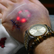 Illustration for article titled The Latest Trend Among Biohackers Is Implanting LED Lights Beneath Your Skin